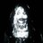 blackpire